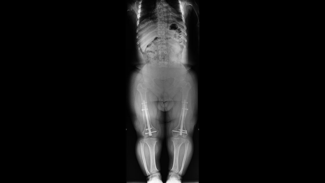E. Y. — Ortoröntgenogram · 24.04.2024 1