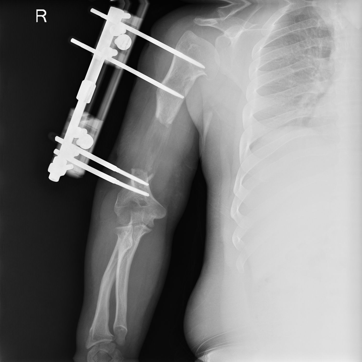 E. Y. — Ortoröntgenogram · 26.06.2024 1