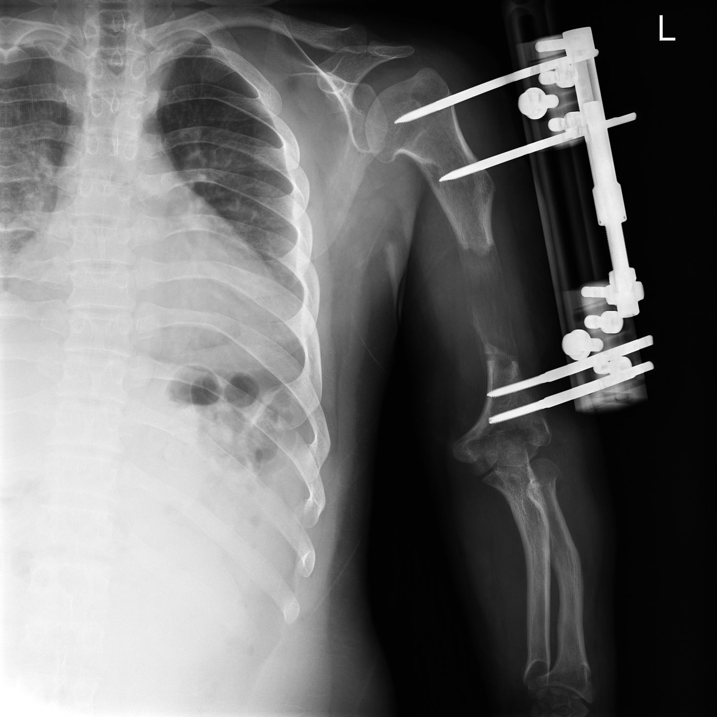 E. Y. — Ortoröntgenogram · 26.06.2024 2