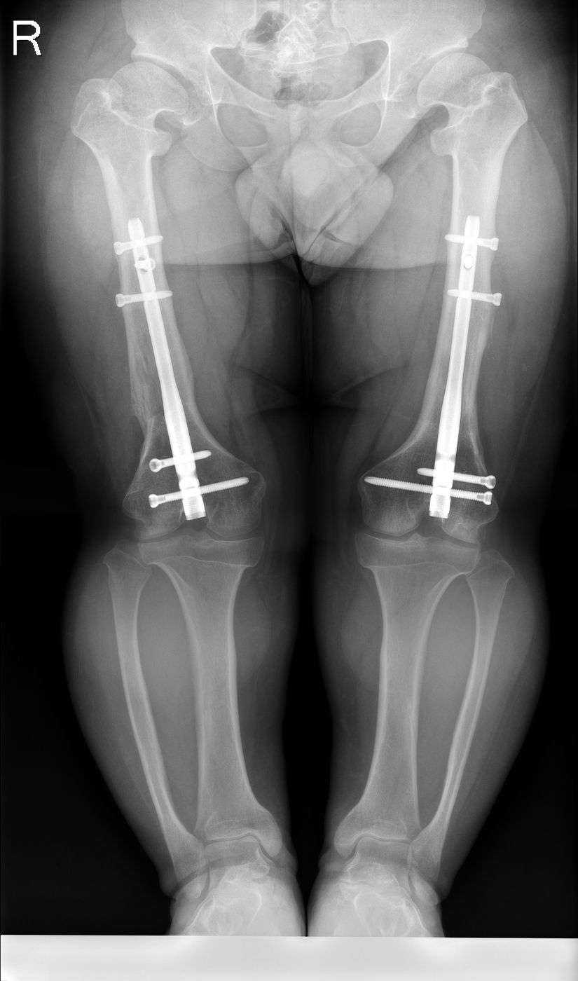 E. Y. — Ortoröntgenogram · 26.06.2024 3