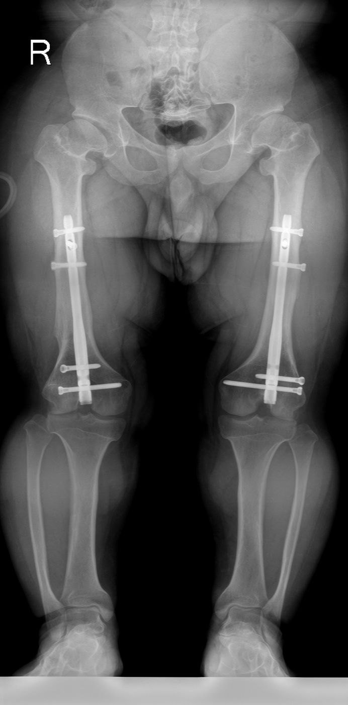 E. Y. — Ortoröntgenogram · 05.10.2024 1
