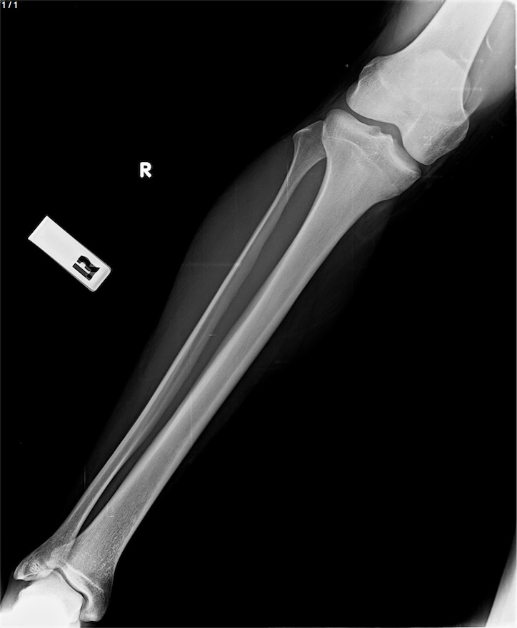 Preop radyografi 1