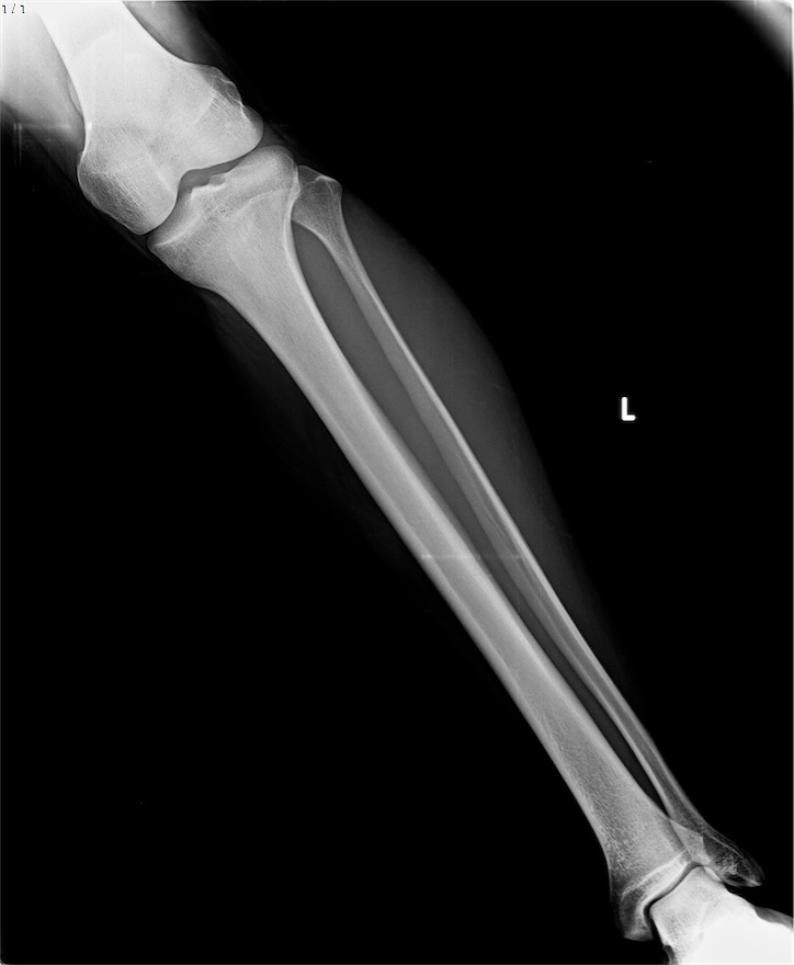 Preop radyografi 2