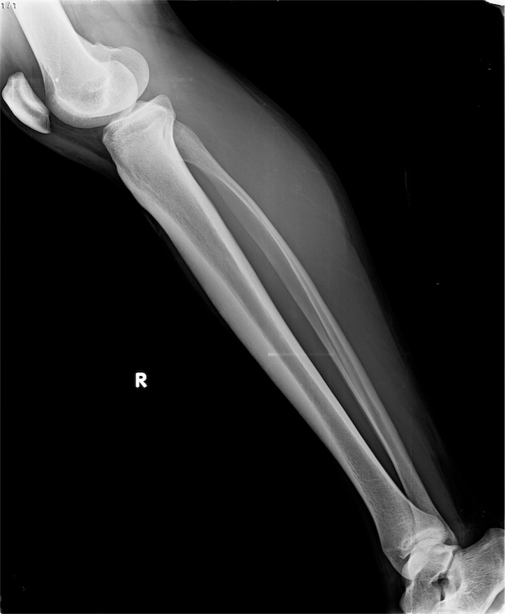 Preop radyografi 3