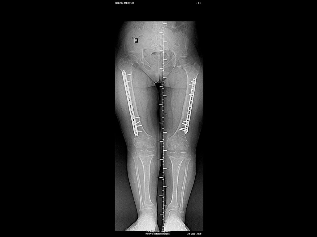 M. U. — Ortoröntgenogram · 24.08.2020 1