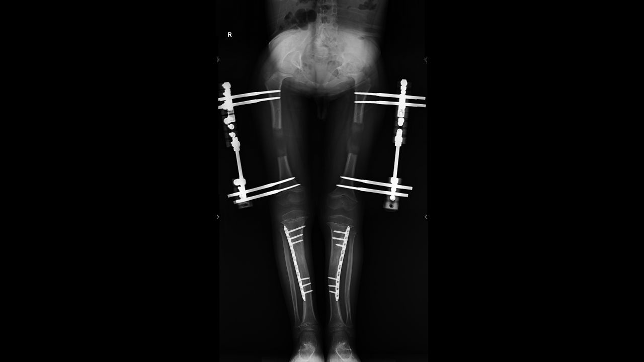 P. O. — Ortoröntgenogram · 18.09.2025 1